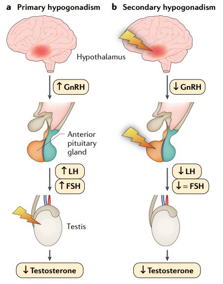 primary and seconday hypogonadism